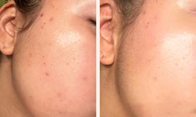 section before after