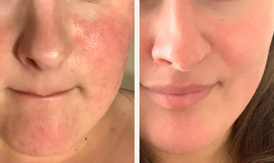 section before after