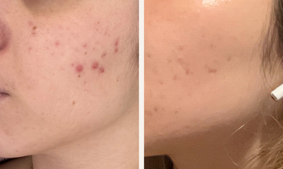 section before after