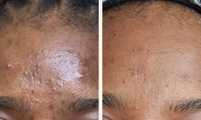 section before after