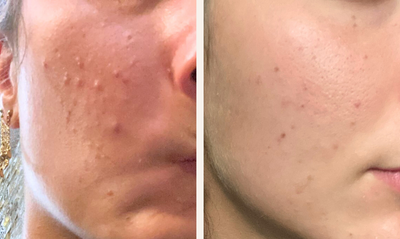 section before after