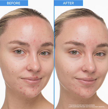 Sérum Doux au Rétinol et Acide Salicylique - Sérum Anti-Imperfections